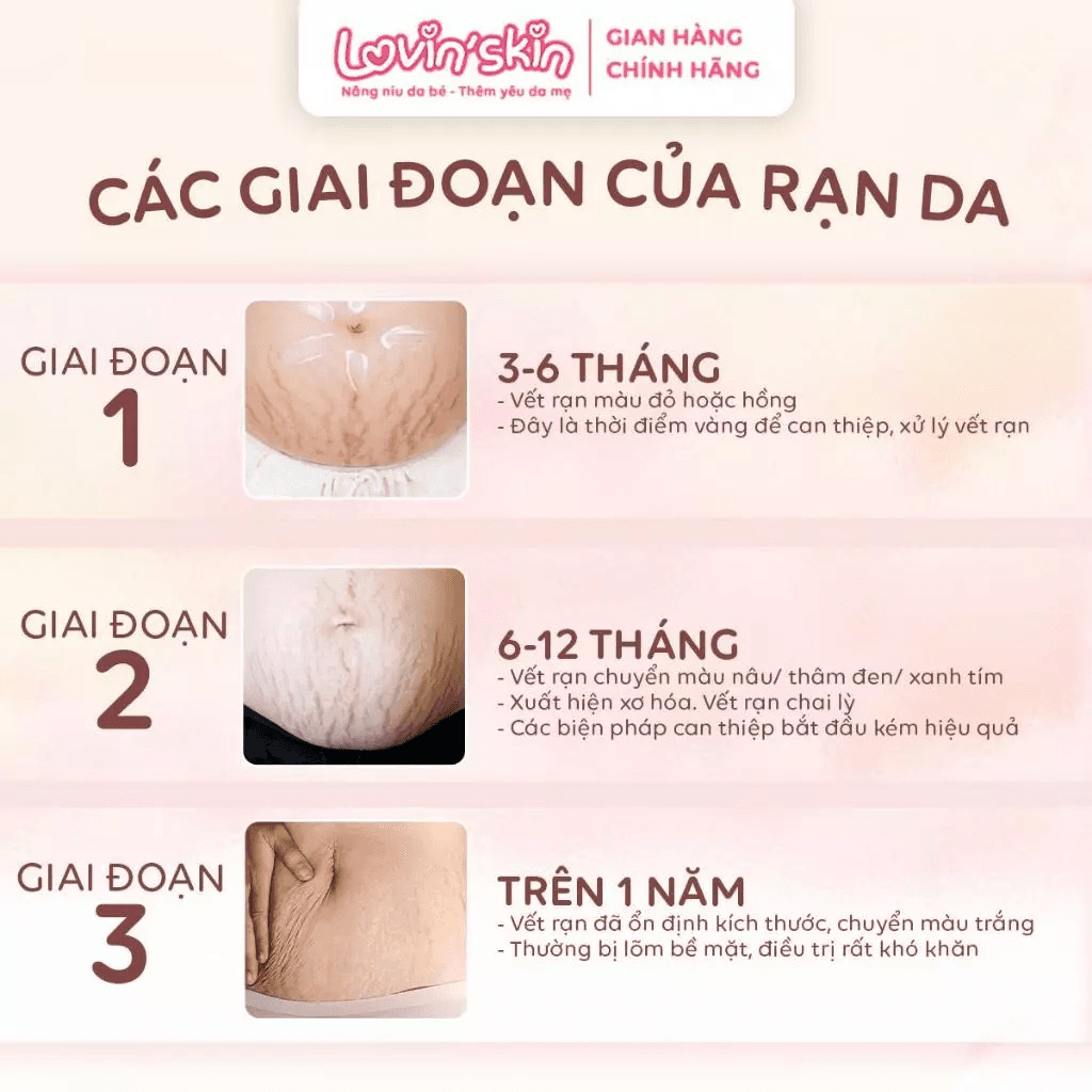 Kem rạn da cho bà bầu Lovin'Skin Mama, hỗ trợ chống rạn hiệu quả, giảm thâm, ngứa da, ngừa hình thành rạn mới - 3